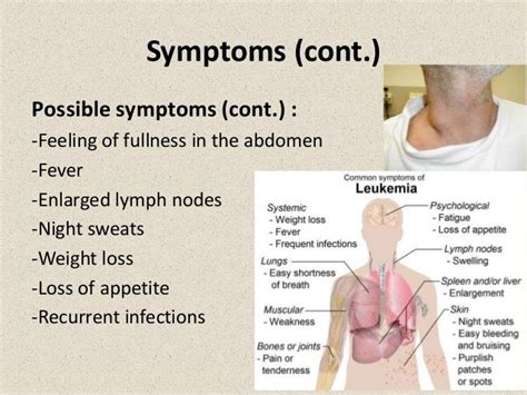 As a result, symptoms usually can impact these areas. leukemia signs and symptoms in adults - Google Search ...