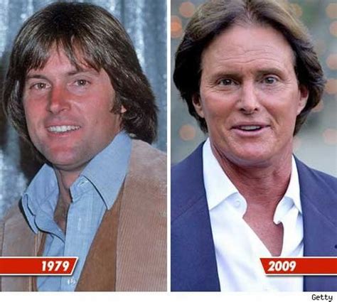 Bruce jenner really gave me the inner strength to admit to my kids, my family, my friends, my fans and ultimately to myself that i am gay. Bruce Jenner Plastic Surgery Gone Wrong: Before & After Photos