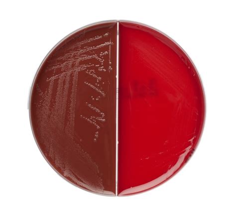 Thermo Scientific Columbia Agar With Blood Chocolate Agar Products