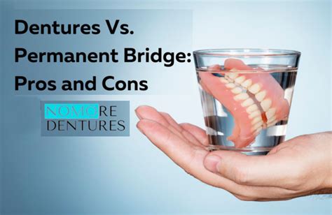 Dentures Vs Permanent Bridge Pros And Cons