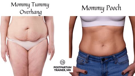 mommy tummy overhang [tips för en platt mage efter graviditeten] tea band