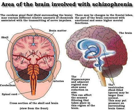 Matter over Mind: Areas of the brain involved with ...