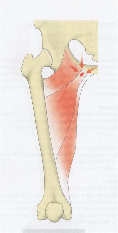 Infiammazione-stappo zona inguinale - Medical Farma ...