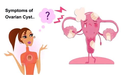 different types of ovarian cysts