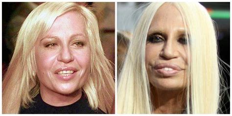 Collage Plastic Surgery Gone Wrong Plastic Surgery Celebrities Female