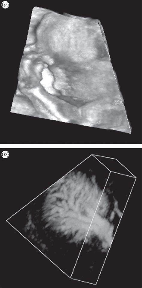 Three Dimensional Ultrasound Scanning Interface Focus