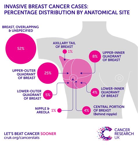 Incidence And Epidemiology Breast Cancer Miami Florida Usa