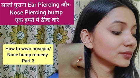 How To Remove Nose Piercing Bumps Giveaway Announcement Get Rid Of Nose Piercing Bump