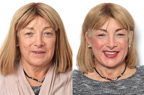 Kellie Maloney Has £3000 Semi Permanent Make Up Treatment Before Her