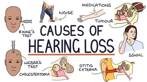 Understanding The Causes Of Hearing Loss Youtube