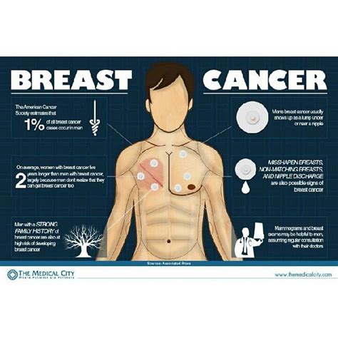 Pictures Of Breast Cancer Lumps Integradas En Salud