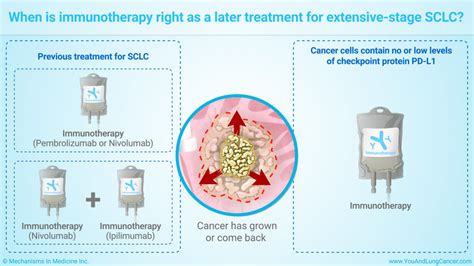 Slide Show Immunotherapy Treatments For Small Cell Lung Cancer Sclc