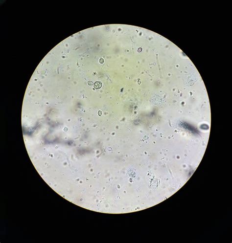 Vista Nel Microscopio Su Trichomonas Std Immagine Stock Immagine Di