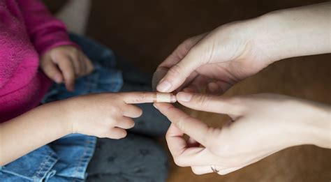 Goresan mural sambut hari kemerdekaan ri. Duh Harus Hati Hati Luka Gores Anak Bisa Bikin Infeksi