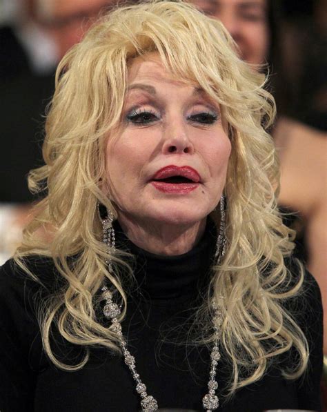 poisoned by botox top doc says dolly has gone too far