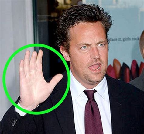 Matthew Perry Lost The Top Portion Of His Middle Finger In A Childhood