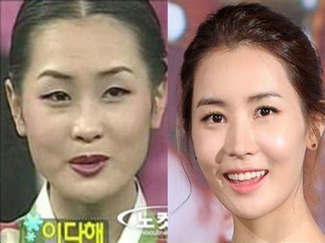 Where Do Korean Celebrities Get Plastic Surgery Makeup And