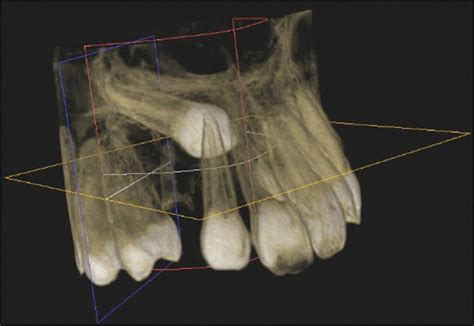 Orthodontic Related Procedures Perioclinik Dr Freddy Fokam