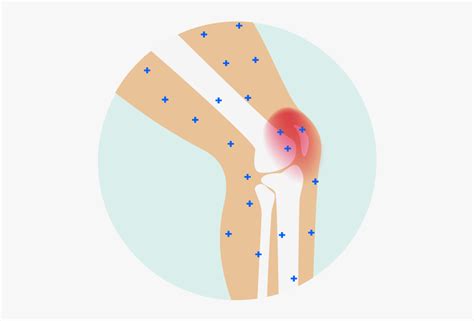 Free Joint Pain Cliparts, Download Free Joint Pain Cliparts png images