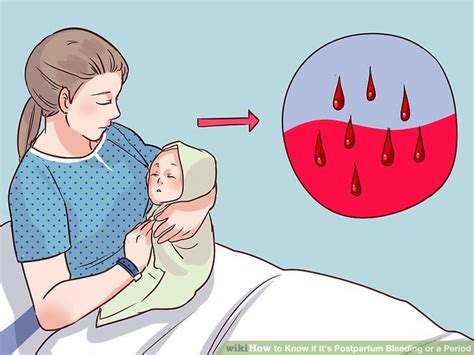 How To Know If Its Postpartum Bleeding Or A Period 10 Steps