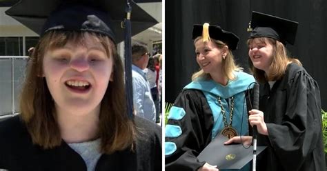 22 year old woman born without nose and eyes successfully graduates from college small joys