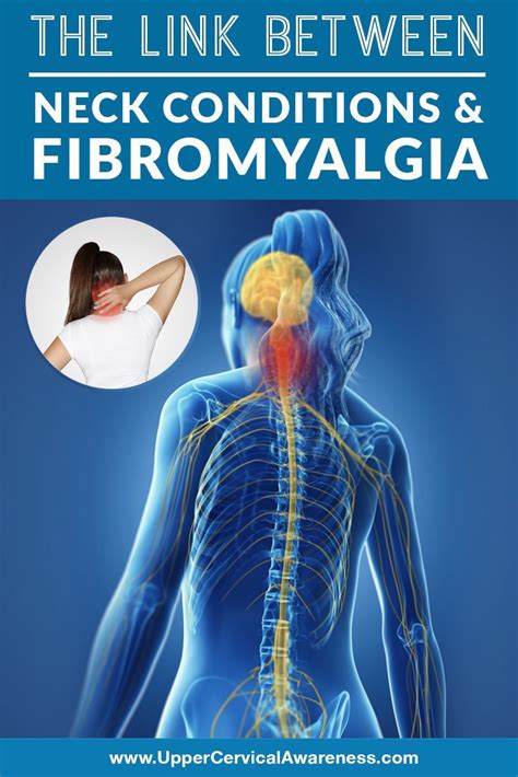 Pin On Fibromyalgia
