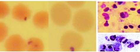 Stained Blood Smear Showed Theileria Protozoan Parasite Of Different