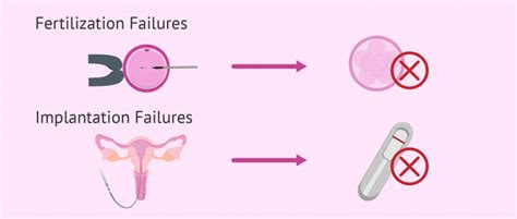 Embryo Implantation Failure Causes Symptoms And Treatments