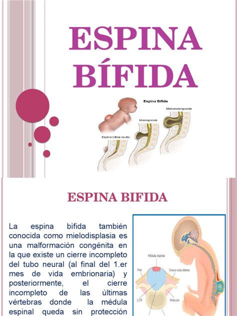 Espina Bifida Pdf Enfermedades Y Trastornos Medicina Clinica
