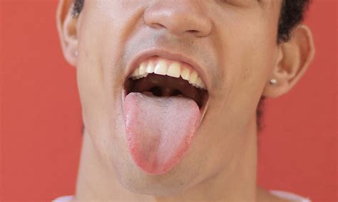 Coated Tongue Symptoms Causes Treatment Curaprox