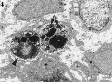 Transmission Electron Microscopy Of Apoptotic Cells Within The Basement