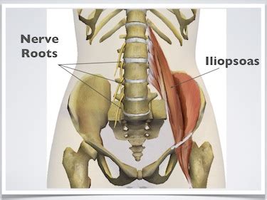 The hip muscles encompass many muscles of the hip and thigh whose main function is to act on the thigh at the hip joint and stabilize the pelvis. Exercises for low back pain: Detailed, easy to follow ...