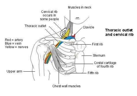 Along with a severe pain under right rib cage, you may also experience diarrhea, flatulence, and other abdominal discomfort. Cervical Rib (Thoracic Outlet Syndrome) | Patient
