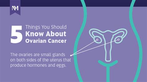 Ovarian Cancer 5 Things To Know Infographic Northwestern Medicine