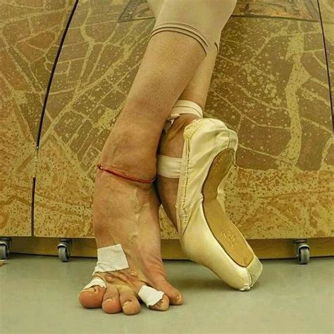Love Hurts Dancers Feet Ballet Feet Ballerina Feet