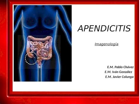 Pptx Apendicitis Patologia Quirurgica Final Dokumen Tips The Best Porn Website