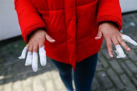 Cute nails for 8 year olds. 13-Year-Old Girl Has Her Fingernails Ripped Off By Group ...