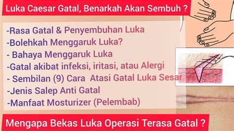 Mama…kenapa muka qaseh hitam.? aku senyum jer dengar soalan kbat dari anak perempuan aku silap pakai muka pun boleh breakout. Kenapa Luka Jahitan Caesar Terasa Gatal? || Keloid, Scar ...