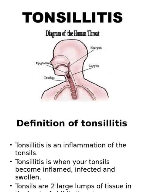 Tonsilitis Medsurg Pdf Medical Specialties Clinical Medicine