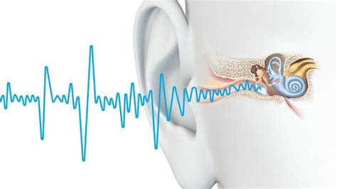 How To Stop Ringing In Ears 3 Ways To Drastically Reduce Tinnitus