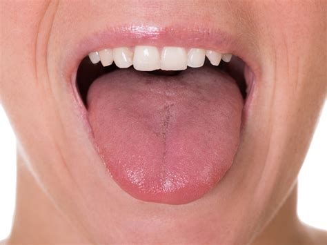 A Fat Tongue May Be Blocking Your Airways While You Sleep Live Science