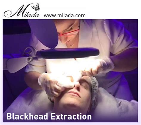 Deep Facial Cleansing Blackhead Removal Facial Spa Milada Montreal