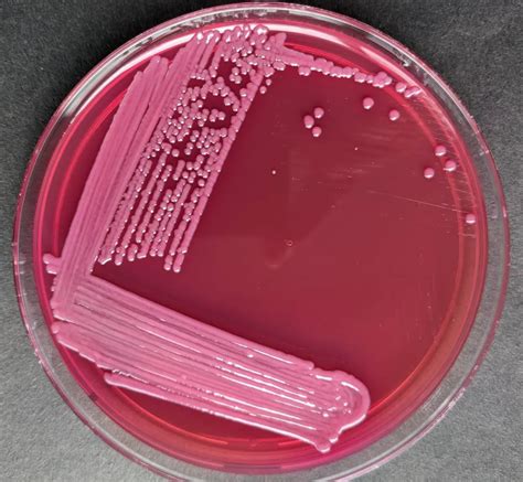 Macconkey Agar Composition Uses Colony Characteristics