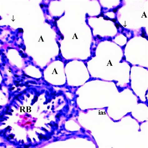 Normal Structural Lung Tissue Parenchyma In The Control Group Hex100