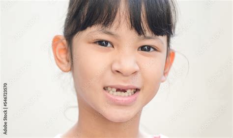 Foto Stock Lost Milk Teeth Lost Baby Tooth Smile Face Of A Child