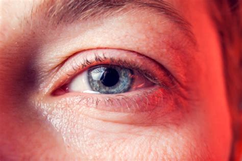 What Causes A Blocked Tear Duct Phoenix Eye Doctor