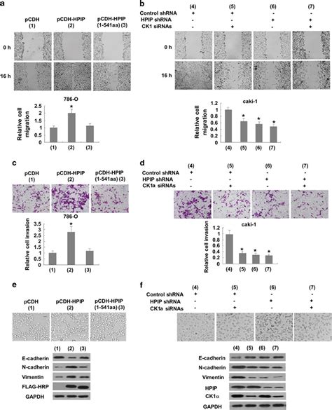 Hpip Promotes Ck Dependent Rcc Cell Migration And Invasion With