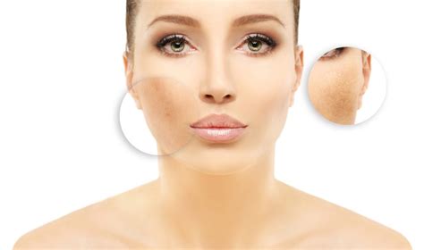 A Guide To Understanding Diffuse Pigmentation In The Skin Business