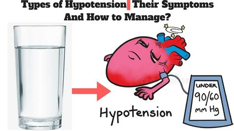Hypotension Clip Art