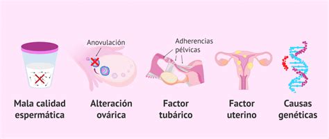 Causas Mas Comunes De Infertilidad En La Mujer Kulturaupice